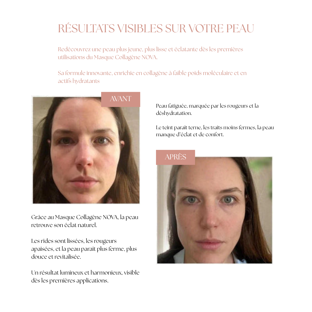 Masque Collagène